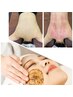 二回目以降【上半身カッピング＋顔ハーブピーリング＋顔脱毛】¥29800