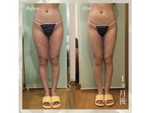 インディバ アンド アイラッシュサロン 新宿の雰囲気（インディバで美容ケア可能です。まつげメニューと同時施術可能◎）
