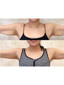 サイズダウンを目指したい