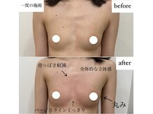 ソワ(soie)の雰囲気（20代後半/出産経験なし/一度の施術/バストアップ/デコルテ/ハリ）