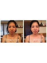 テイクオフ(Takeoff)/造顔マッサージ/小顔矯正