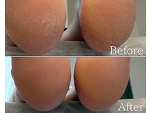 カシェット 広島店(Cachette)/40代女性☆足裏角質ケア90分