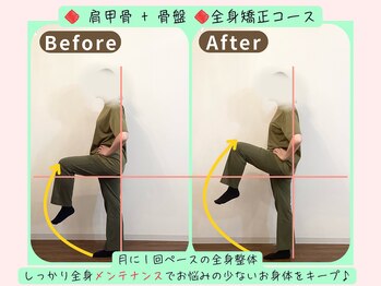 リフィール 国分寺店/Before&After【骨盤/姿勢/整体】