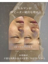 ヒュウ(hue.)/韓国発最新肌管理[セルマン]