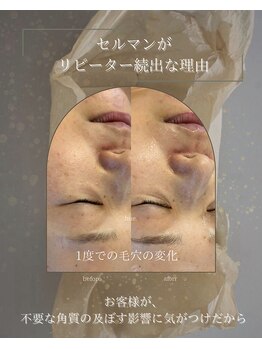 ヒュウ(hue.)/韓国発最新肌管理[セルマン]