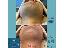 プライオリティ(Priority)