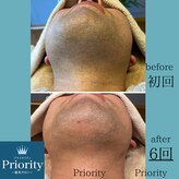 プライオリティ(Priority)