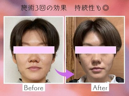 スマイルエム(SmileM)の写真