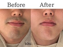 ソウ 越前店(sou.)/