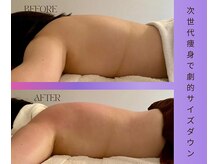 トータルエステサロン エステアンドメイク 錦糸町の雰囲気(ブライダル特化サロン/多数の実績/挙式直前駆け込みクーポンあり)