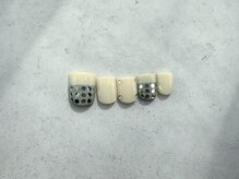 ネイルアンドアイラッシュ サロン エルザ(Nail&Eyelash Salon Elsa)/【初回オフ無料】¥8980