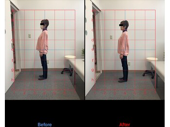 リード整骨院(LEAD整骨院)/姿勢改善、猫背、反り腰