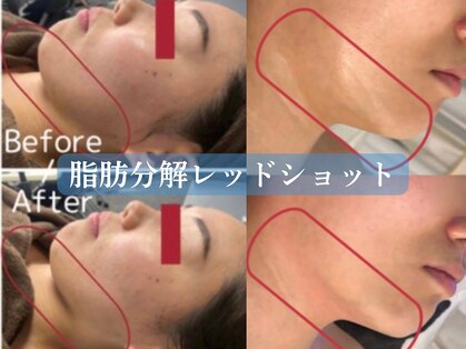 シュリー(Sriii)の写真