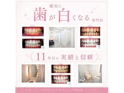 ホワイトニングショップ 町田店の写真