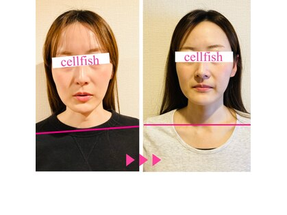 セルフィッシュ(Cellfish)の写真