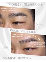 リノア(Linoa)/メンズ眉毛ビフォーアフター