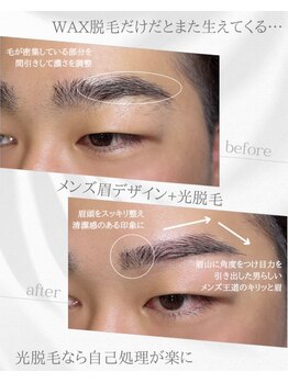 リノア(Linoa)/メンズ眉毛ビフォーアフター