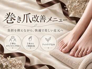 シノア(cynoa)の写真/どんな悩みをお持ちの方でもフットネイルを一緒に楽しみたい！巻き爪対応の道具、ジェルでしっかりケア♪