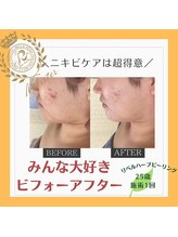 ルキア(LUKIA)/赤いプチには早めのハーブを◎