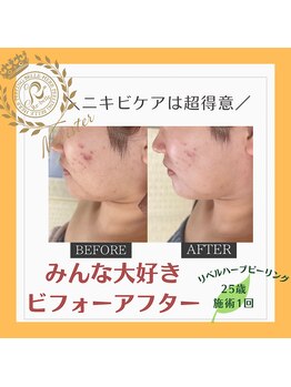 ルキア(LUKIA)/赤いプチには早めのハーブを◎