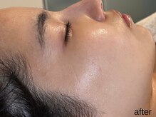 サロン ド エメ(salon de aimer)/【After】圧倒的透明感！