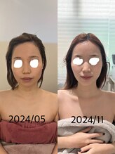 ジョワ 黒崎店(joie)/速攻！別人級