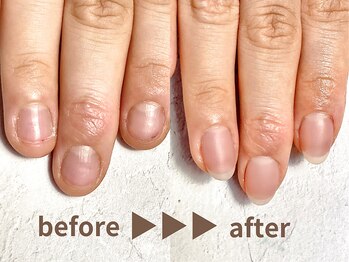 深爪から長さ出し+自爪風カラー