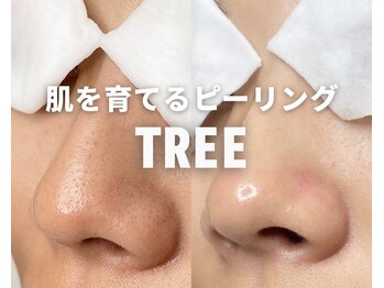 アイラッシュツリー(eyelash TREE)の写真/【剥けない優しいピーリング★集中4回コース】日々のスキンケアとの相乗効果で肌育◎透明感のある柔肌に！