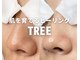 アイラッシュツリー(eyelash TREE)の写真/【剥けない優しいピーリング★集中4回コース】日々のスキンケアとの相乗効果で肌育◎透明感のある柔肌に！