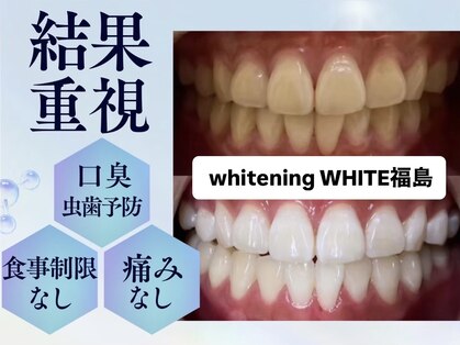 ホワイトニングサロン ホワイト(WHITE)の写真