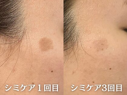 ゼロ美人 那覇店(ZERO美人)の写真