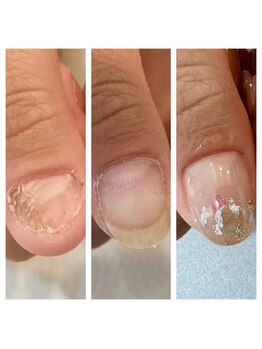 リーフ(Leaf)/ダメージトラブル爪のお悩み