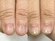 ティティーネイル(titynail)の写真