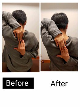 アース エンジェル整体院/ビフォアフ 肩甲骨はがし