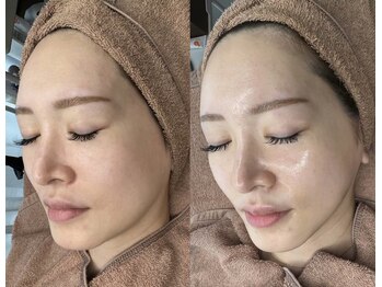 ムゥ(Mwoo)/ララピール/ララピール西宮