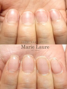 マリーロール 梅田店(Marie Laure)/深爪矯正/自爪育成/自爪風