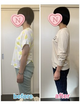 ニーナ(neena)/反り腰/骨盤矯正/腰痛整体