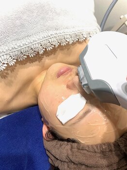 ハーニーズ(HARNEYS)/【美肌顔脱毛】照射