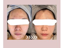 ナトゥーラ(NatuLa)/ハンドの技術と機械の融合