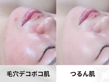 オクタボー 南青山(OCTAVO)/オーナーの肌