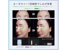 オフモード(OffMode)/一回の施術でシワが改善