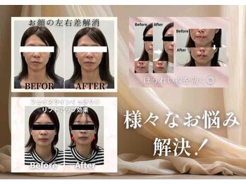 うさぎ鍼灸整骨院/うさぎ式美容鍼+ヘッドスパ