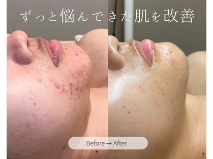 アール(R;)の写真