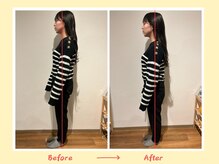 アイノテ メディカルボディケア(Ainote medical body care)/［姿勢改善の施術例紹介］