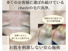 シェリール 大宮(cherir)の雰囲気（敏感肌の方、初めての方も安心！お肌の土台を強化しながらケア。）