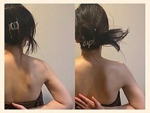 ラフリー 八丁堀院(RUFFREE)/肩甲骨はがし/整体は痩身効果も