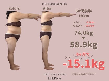 エテルナ(Eterna)の写真