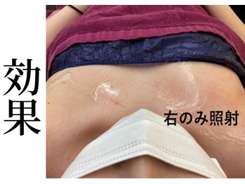 ポインセチア(Poinsettia)/【必見】超音波バストアップ効果