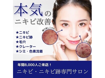 ニキビケア研究所 本厚木店の写真