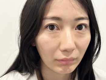 トミー(Tommy)/まつげパーマ